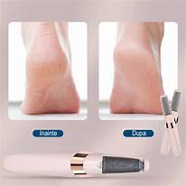 Lima Callos Exfoliante Pies