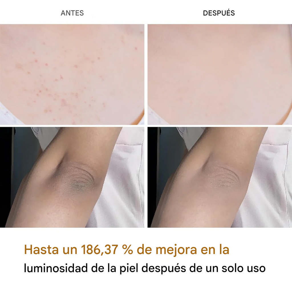 Exfoliante Melaxin - Para Aclarar Partes Oscuras - Fórmula Cúrcuma | Nozeshop